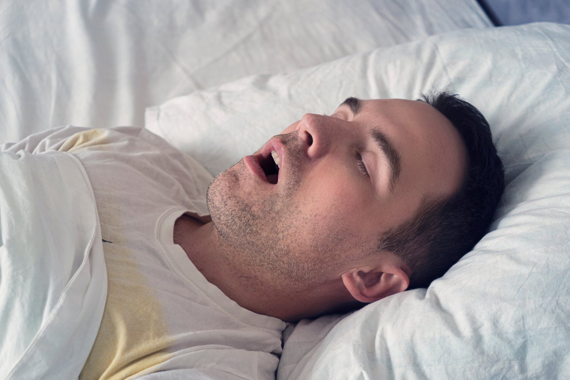 Portrait of a man sleeping with an open mouth. The problem of snoring during sleep. A young cute guy sleeps on a white bed at day or morning.