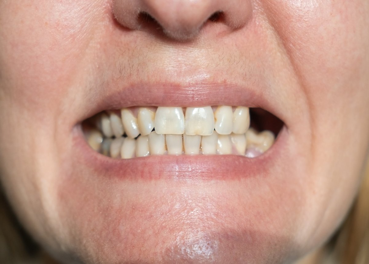 Mature woman is showing mouth without broken tooth. Close-up photo. Gap toothed