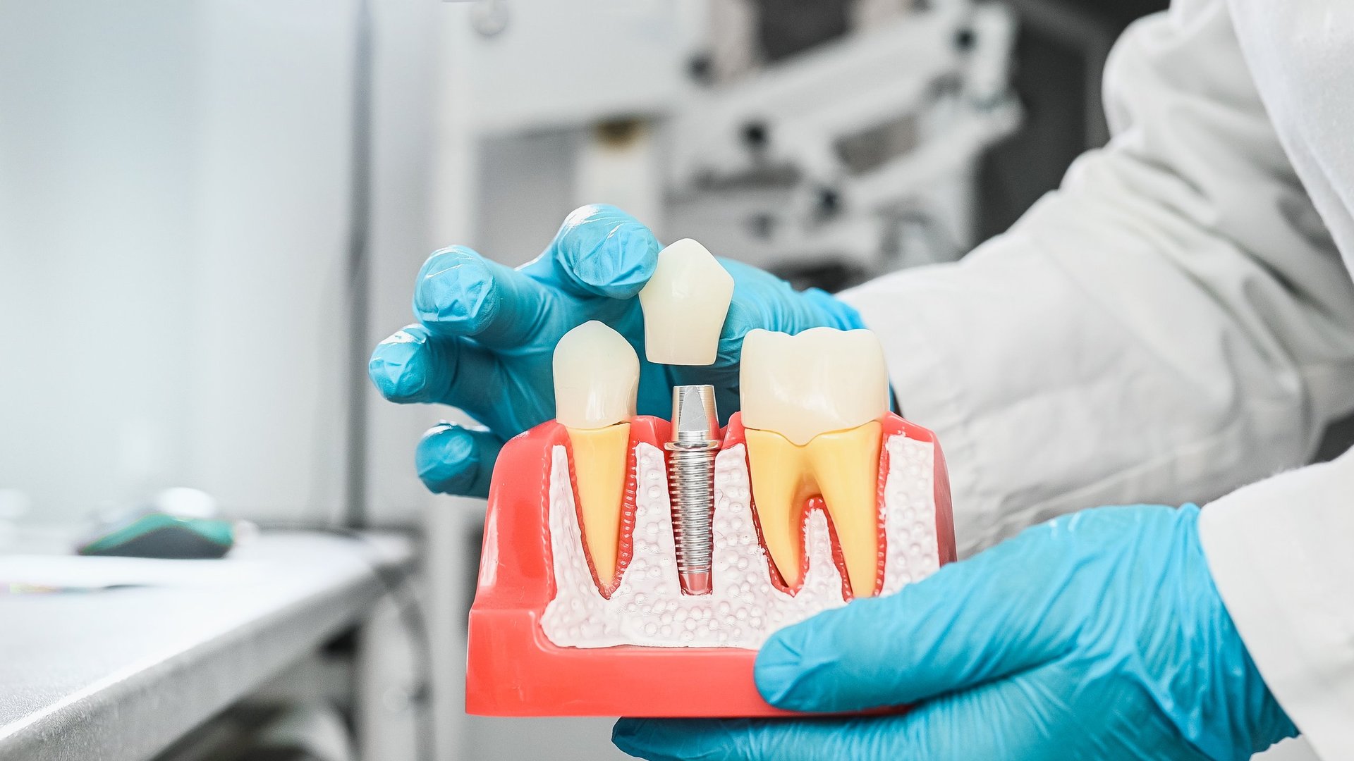 Concept for dentistry, dental implantation